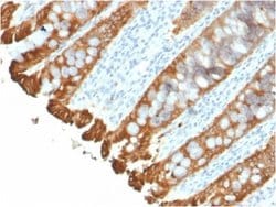 Cytokeratin 8/18 Antibody (KRT8.18/2297R) - Azide and BSA Free, Novus Biologicals 100 &mu;g | Buy Online | Novus Biologicals | Fisher Scientific
